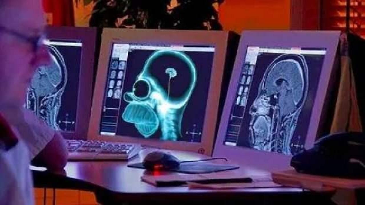 Zihin okuma teknolojisinde bir ilk: Bilim insanları görüntüleri ekrana yansıtmayı başardı!