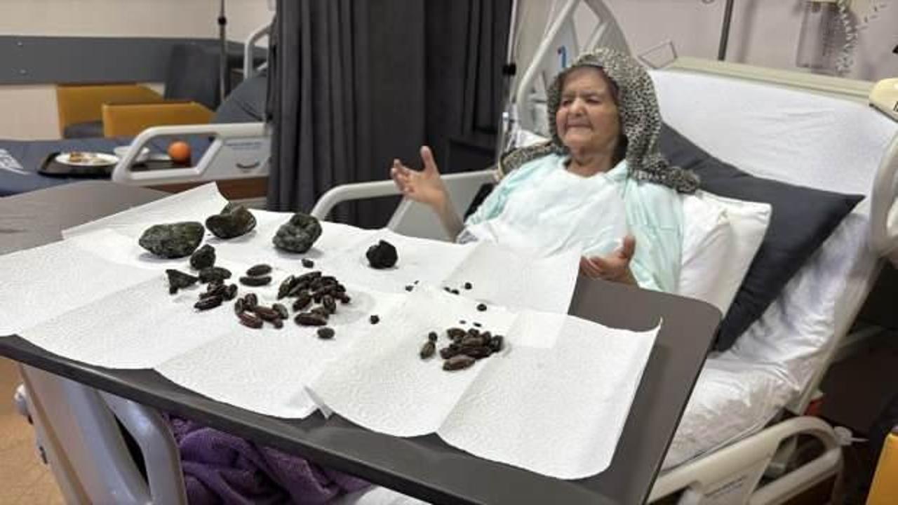 Zonguldak'ta 92 yaşındaki kadının midesinden çıkanlar şoke etti